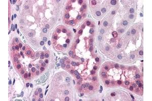 Immunohistochemical analysis of paraffin-embedded human Liver tissues using anti-BHMT antibody (ERK1/2 抗体)