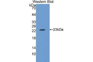 Western Blotting (WB) image for anti-Ferritin, Heavy Polypeptide 1 (FTH1) (AA 1-182) antibody (ABIN1078027) (FTH1 抗体  (AA 1-182))