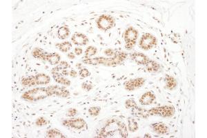 Immunohistochemistry (IHC) image for anti-Ribosomal Protein S6 Kinase, 90kDa, Polypeptide 2 (RPS6KA2) (AA 1-50) antibody (ABIN7454506)