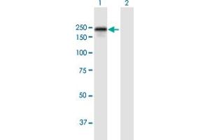 Western Blot analysis of DLC1 expression in transfected 293T cell line by DLC1 MaxPab polyclonal antibody. (DLC1 抗体  (AA 1-1528))