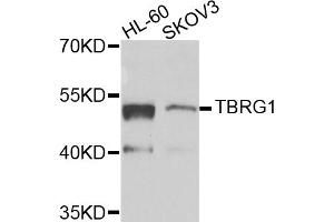 Western blot analysis of extracts of various cell lines, using TBRG1 antibody (ABIN5975095) at 1/1000 dilution. (TBRG1 抗体)