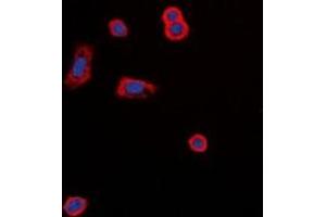 Immunofluorescent analysis of MC5 Receptor staining in MCF7 cells. (MC5 Receptor 抗体  (C-Term))