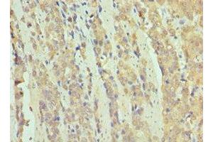 Immunohistochemistry (IHC) image for anti-SWI/SNF Related, Matrix Associated, Actin Dependent Regulator of Chromatin, Subfamily B, Member 1 (SMARCB1) (AA 86-385) antibody (ABIN7171070)