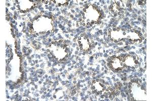 Rabbit Anti-JUN Antibody       Paraffin Embedded Tissue:  Human alveolar cell   Cellular Data:  Epithelial cells of renal tubule  Antibody Concentration:   4. (C-JUN 抗体  (N-Term))