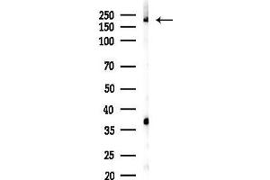 anti-ADP-Ribosylation Factor Guanine Nucleotide-Exchange Factor 1(brefeldin A-Inhibited) (ARFGEF1) antibody