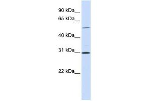 NEK3 antibody used at 1 ug/ml to detect target protein. (NEK3 抗体)