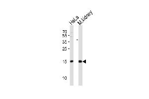 Western blot analysis of lysates from HeLa cell line, mouse kidney tissue lysate (from left to right), using CDA Antibody at 1:1000 at each lane. (CDA 抗体  (C-Term))
