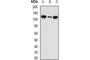 Western blot analysis of INTS5 expression in MCF7 (A), HT29 (B), mouse liver (C) whole cell lysates. (INTS5 抗体)