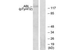 Western blot analysis of extracts from RAW264. (ABL1 抗体  (pTyr393))