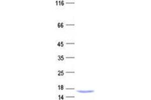 Western Blotting (WB) image for Integrator Complex Subunit 6 (INTS6) protein (His tag) (ABIN5505691)