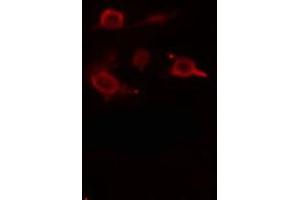 ABIN6275499 staining  RAW264. (ARHGEF5 抗体  (Internal Region))