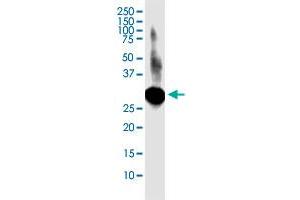 LACTB2 monoclonal antibody (M02), clone 1H3. (LACTB2 抗体  (AA 1-288))