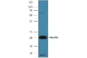 Mouse brain lysates probed with Anti- Neuritin Polyclonal Antibody, Unconjugated  at 1:300 overnight at 4˚C. (NRN1 抗体  (AA 51-142))