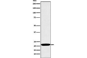 Western blot analysis of Oncostatin M expression in Jurkat cell lysate.