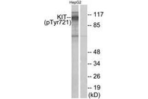 Western Blotting (WB) image for anti-Mast/stem Cell Growth Factor Receptor (KIT) (pTyr721) antibody (ABIN2888461) (KIT 抗体  (pTyr721))