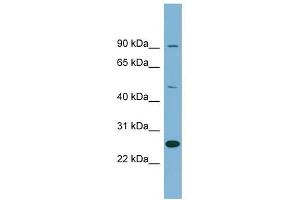 LRRC49 antibody used at 1 ug/ml to detect target protein. (LRRC49 抗体  (N-Term))