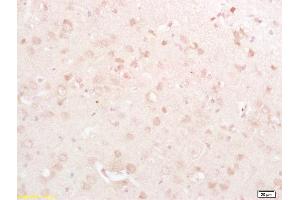 Formalin-fixed and paraffin embedded rat brain labeled with Rabbit Anti DRP1/DNM1L Polyclonal Antibody, Unconjugated  at 1:200 followed by conjugation to the secondary antibody and DAB staining (CSRP2 抗体  (AA 101-200))