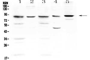 Western blot analysis of NADPH oxidase 4 using anti-NADPH oxidase 4 antibody . (NADPH Oxidase 4 抗体)