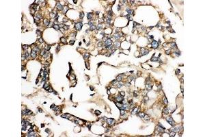 Immunohistochemistry (IHC) image for anti-Solute Carrier Family 10 (Sodium/bile Acid Cotransporter Family), Member 1 (SLC10A1) (AA 141-154) antibody (ABIN3032668)