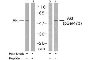 Western blot analysis of extract from HeLa cells untreated or treated with heat shock using Akt (Ab-473) antibody (E021054, Lane 1 and 2) and Akt (phospho-Ser473) antibody (E011054, Lane 3 and 4). (AKT1 抗体  (pSer473))
