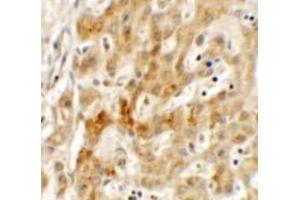 Immunohistochemistry of TMEM106B in human liver tissue with TMEM106B antibody at 2. (TMEM106B 抗体  (N-Term))