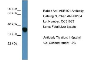 WB Suggested Anti-AKR1C1  Antibody Titration: 0. (AKR1C1 抗体  (N-Term))
