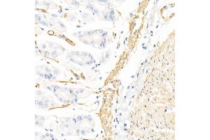 Immunohistochemistry of paraffin-embedded rat kidney using Caspase-7 Rabbit pAb (ABIN3022071, ABIN3022072, ABIN3022073 and ABIN6218596) at dilution of 1:150 (40x lens). (Caspase 7 抗体  (AA 24-303))