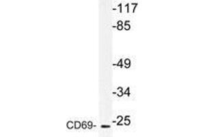 Western blot (WB) analysis of CD69 antibody in extracts from HUVEC cells. (CD69 抗体)