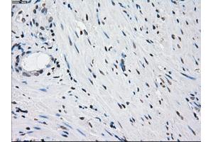 Immunohistochemical staining of paraffin-embedded pancreas tissue using anti-PRKYmouse monoclonal antibody. (PRKY 抗体)
