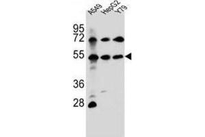Western Blotting (WB) image for anti-Fibroblast Growth Factor Receptor-Like 1 (FGFRL1) antibody (ABIN2996911) (FGFRL1 抗体)