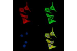 anti-Myeloid-Associated Differentiation Marker (MYADM) antibody