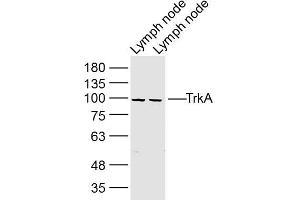 Lane 1: mouse lymph node lysates Lane 2: rat Lymph node lysates probed with TrkA Polyclonal Antibody, Unconjugated  at 1:300 dilution and 4˚C overnight incubation. (TRKA 抗体  (AA 725-821))