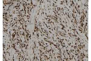 ABIN6272973 at 1/100 staining Human gastric tissue by IHC-P. (PBXIP1 抗体  (C-Term))
