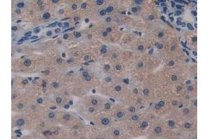 Detection of BGN in Human Liver Tissue using Polyclonal Antibody to Biglycan (BGN) (Biglycan 抗体  (AA 230-366))