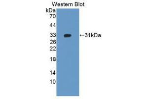 Western blot analysis of the recombinant protein. (ADAM12 抗体  (AA 513-767))