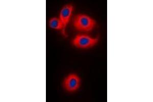 Immunofluorescent analysis of MRPS22 staining in HEK293T cells. (MRPS22 抗体)