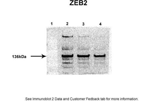ZEB2 抗体  (Middle Region)