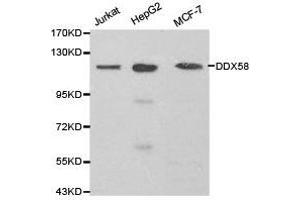 Western Blotting (WB) image for anti-DEAD (Asp-Glu-Ala-Asp) Box Polypeptide 58 (DDX58) antibody (ABIN1872240) (DDX58 抗体)