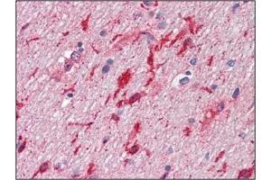 Immunohistochemistry (IHC) image for anti-Hepatocyte Growth Factor (Hepapoietin A, Scatter Factor) (HGF) antibody (ABIN492557) (HGF 抗体)