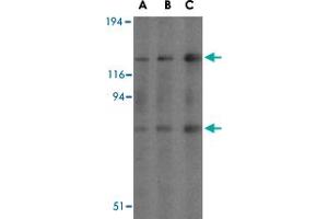 Western blot analysis of AGAP2 in mouse brain tissue lysates with AGAP2 polyclonal antibody  at (A) 0. (AGAP2 抗体  (C-Term))