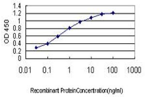 Detection limit for recombinant GST tagged BRD2 is approximately 0. (BRD2 抗体  (AA 167-256))