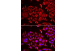 Immunofluorescence analysis of HeLa cells using TARS antibody (ABIN5974207). (TARS 抗体)