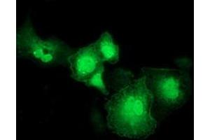 Anti-RASD2 mouse monoclonal antibody (ABIN2453962) immunofluorescent staining of COS7 cells transiently transfected by pCMV6-ENTRY RASD2 (RC201454). (RASD2 抗体)