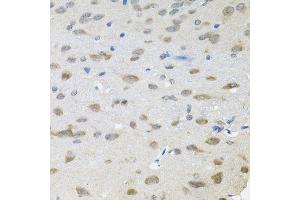 Immunohistochemistry of paraffin-embedded rat brain using TRPC1 antibody (ABIN6003660) (40x lens). (TRPC1 抗体)