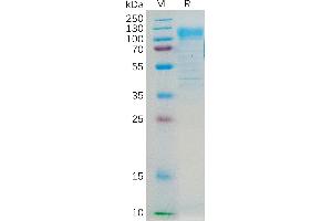 SDS-PAGE (SDS) image for CD36 (CD36) (AA 30-439) protein (Fc Tag) (ABIN7092680)