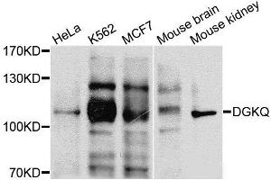 Western blot analysis of extracts of various cells, using DGKQ antibody. (DGKQ 抗体)