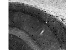 Adult rat hippocampus immunohistochemistry.