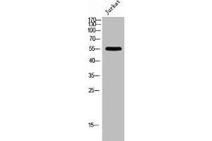 Western Blot analysis of Jurkat cells using PFK-2 liv Polyclonal Antibody (PFKFB1 抗体  (C-Term))