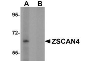 Western blot analysis of ZSCAN4 in mouse lung tissue lysate with AP31008PU-N in (A) the absence and (B) presence of peptide blocking. (ZSCAN4 抗体  (C-Term))