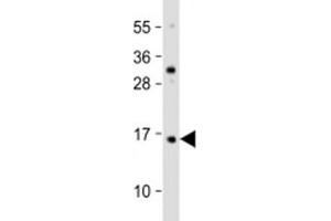 Western blot testing of human HaCaT cell lysate with TCTA antibody at 1:2000. (TCTA 抗体  (AA 23-55))